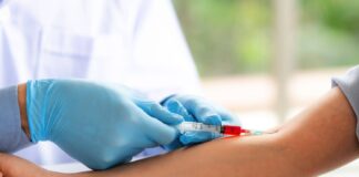 Τι είναι το HIV Στίγμα