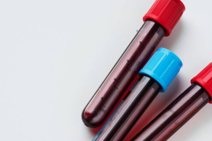 Δραματική έκκληση για αιμοδοσία - Οριακά η επάρκεια αίματος λόγω πανδημίας