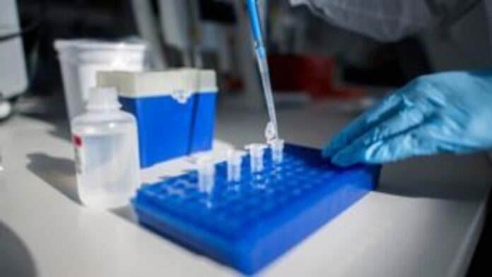 Κορονοϊός: Νέο διαγνωστικό τεστ αντιγόνων δίνει αποτελέσματα σε 5 λεπτά
