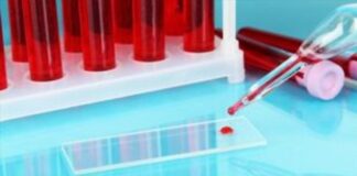 Τεστ αίματος θα δείχνει στο μέλλον αν ένα εμβόλιο Covid-19 «δουλεύει»